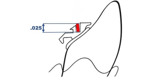 Vertical dimension ( .025 ) and close relation to the center of resistance are working against proclination forces on the lower incisors