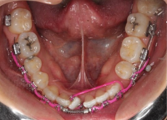 Figure 7b from Sturgill Case Study