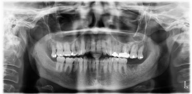 Figure 10: Dental Panorex