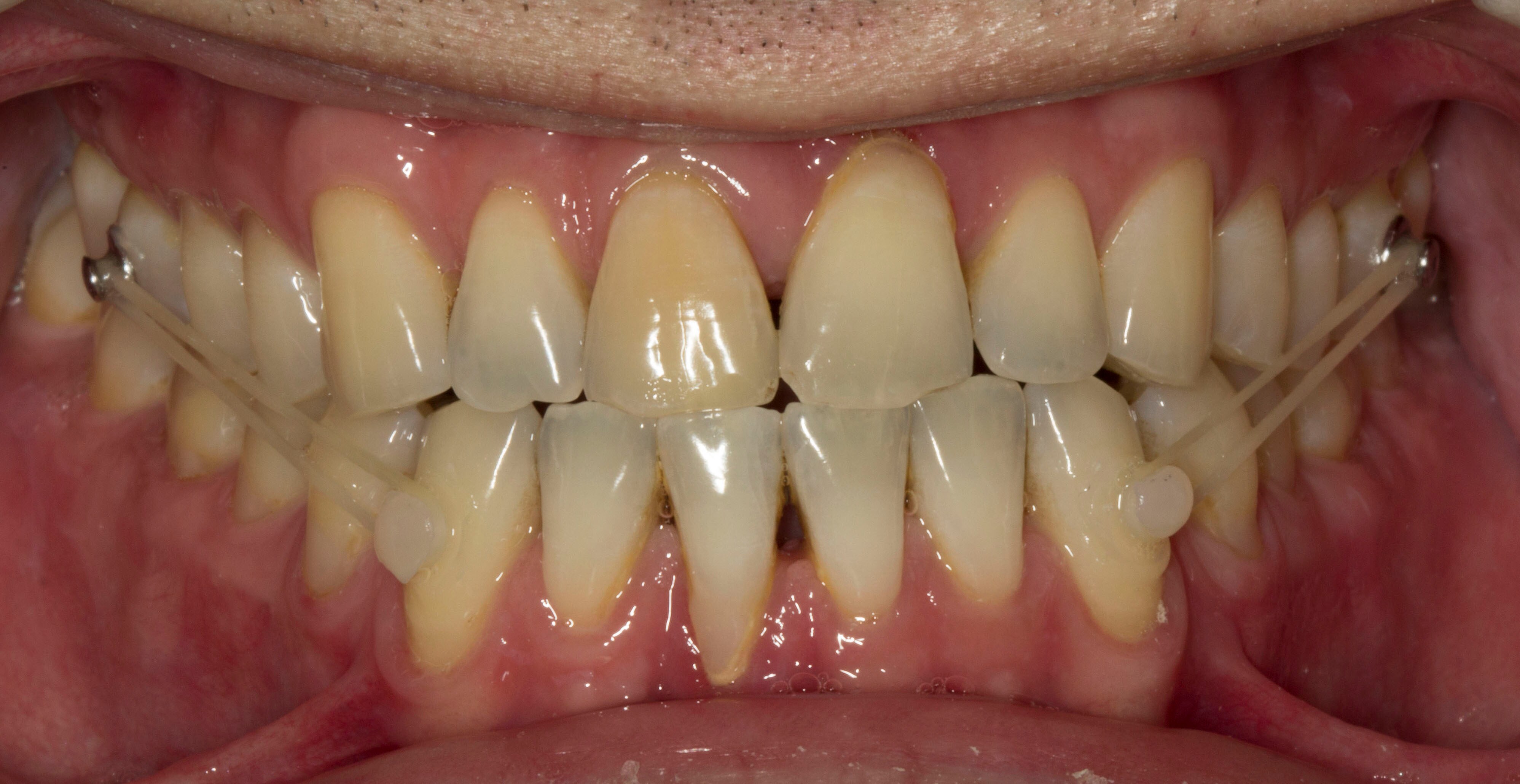 Figure 2a from Polat-Ozsoy Case Study