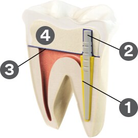 RelyX™ Fiber Post 3D Glass Fiber Post tooth cutaway diagram
