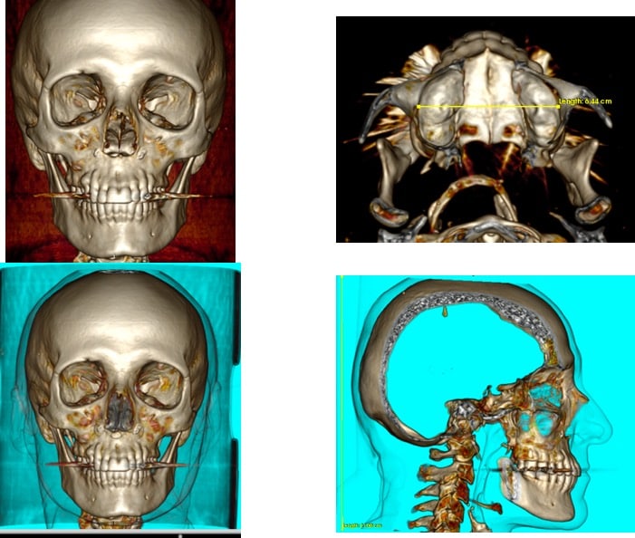 Table 5’’: Images of 3D scanner