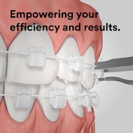 Video explaining the functions of 3M Clarity Ultra Self-Ligating Orthodontic Brackets.