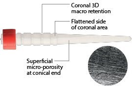 RelyX™ Fiber Post 3D Glass Fiber Post Benefits Callouts