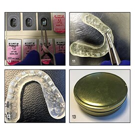 Load the 3M™ APC™ Flash-Free Adhesive brackets into the tray and store until the bonding appointment