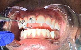 Fernandes Practice Efficiency Tooth Photo