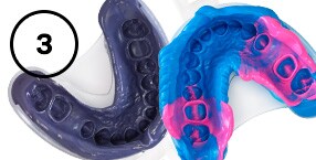 Imprint™ and Impregum™ Impression Materials

