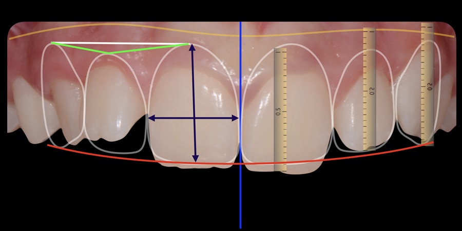 Figure 5b from Riatti Case Study